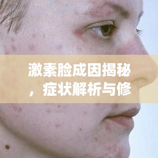 激素脸成因揭秘,症状解析与修复策略专题